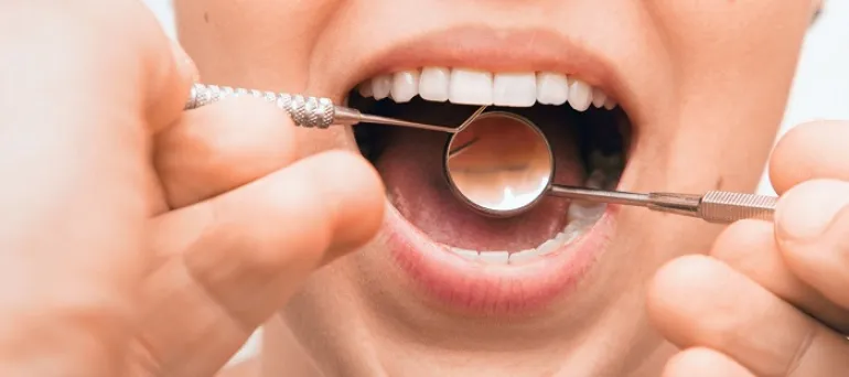 Οι 4 ασθένειες που φαίνονται στα δόντια μας