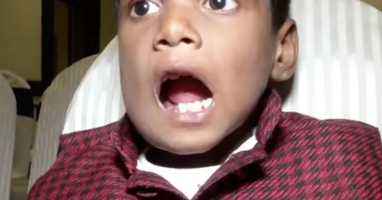 Ινδία: Έβγαλαν 526 δόντια από το στόμα 7χρονου αγοριού 
