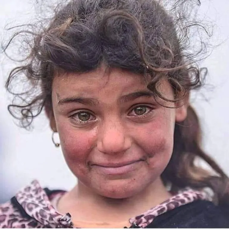 Συρία: αυξάνονται τα θύματα μεταξύ των αμάχων, φωτορεπόρτερ ζητάει από παιδάκι να χαμογελάσει